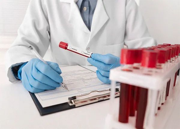 Advanced Blood Testing