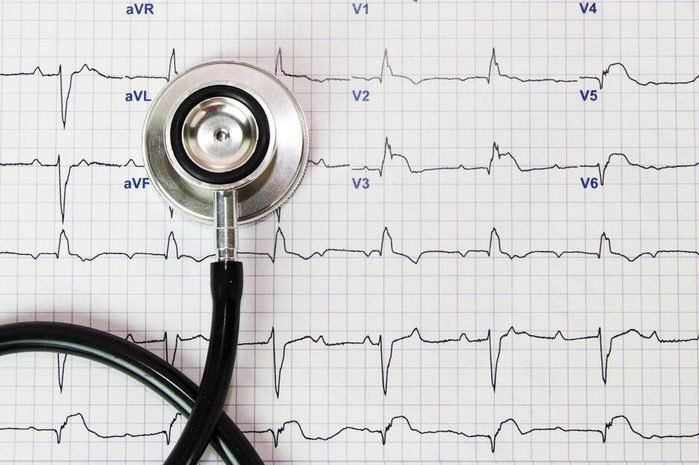 ECG & Cardiac Evaluation